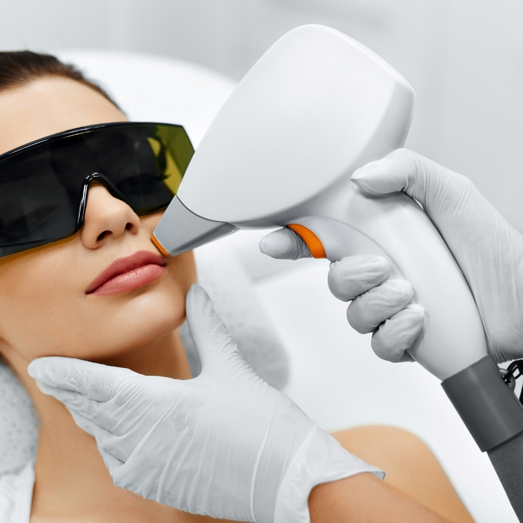 fisiocare epilazione laser viso