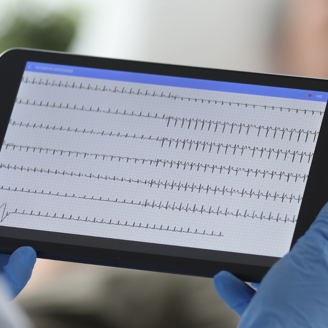 Fisiocarelab - ECG holter a Giugliano in Campania - fisiocarelab