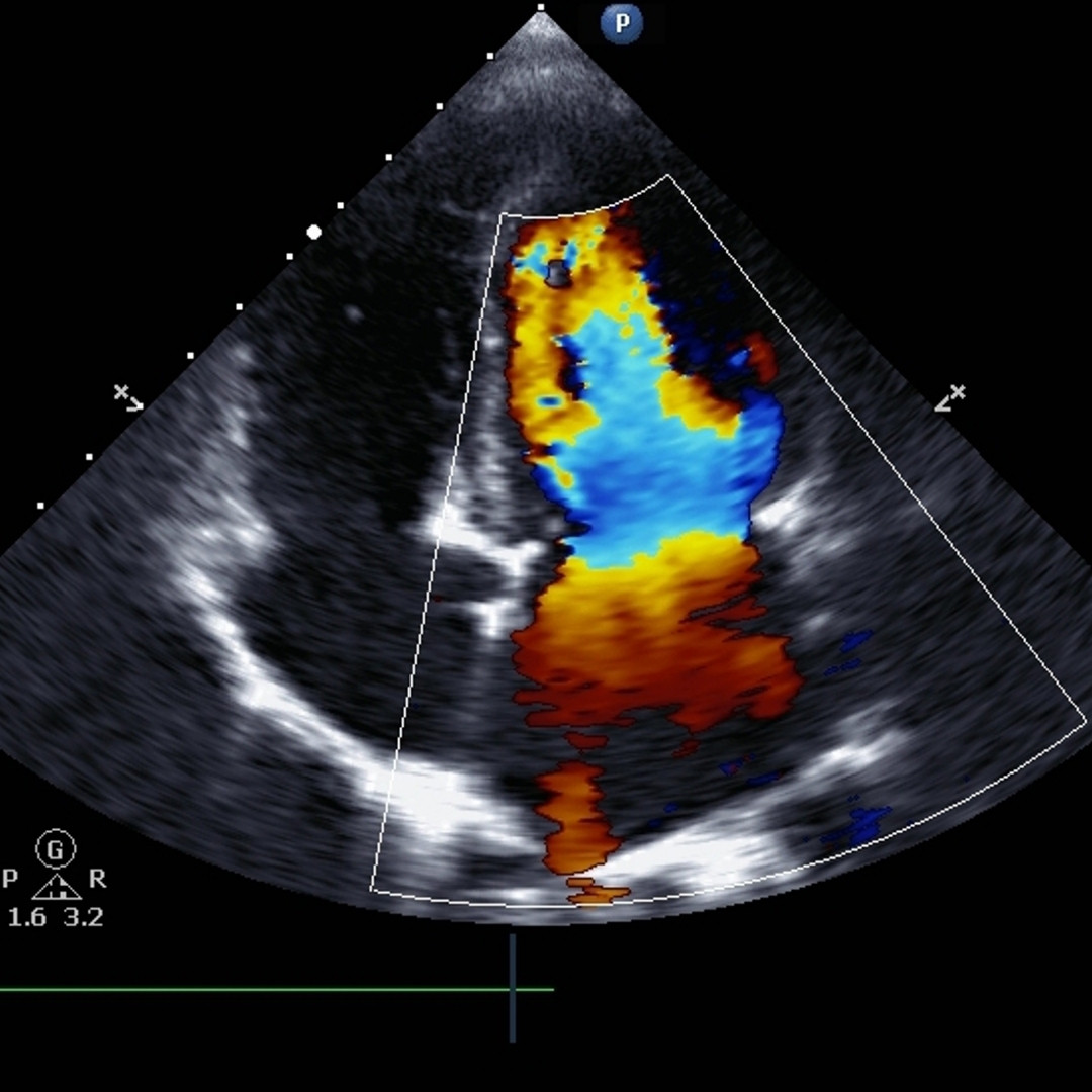 Ecocardiogramma Color Doppler a Giugliano in Campania - Fisiocarelab